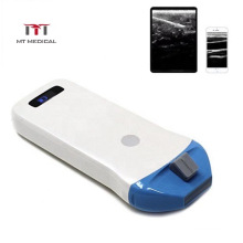 Mini Portable Wireless Color Doppler Convex Ultrasound Probe